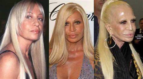 foto donatella versace 2018|donatella versace before and after.